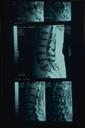 A&P lecture 7: Arthrology/Joints - Digital Download