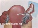 ap1.2.13 repro - Digital Download