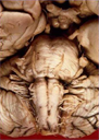 Cranial Nerves and Tracts 2010 - Digital Download